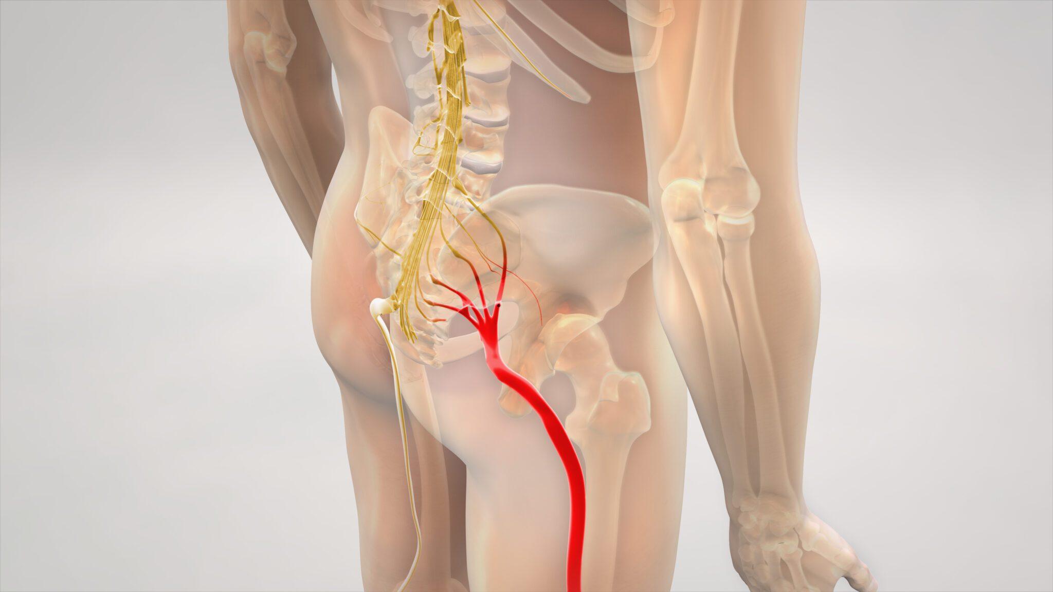 Do I Have Sciatica | Sciatica Symptoms | Doctor Explanation ...